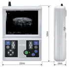 Автономный специализированный портативный ультразвуковой сканер HS-1600