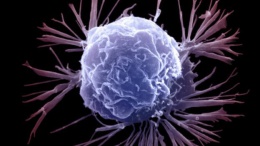 Вакцина вместо химиотерапии: в Британии нашли "ахиллесову пяту" рака