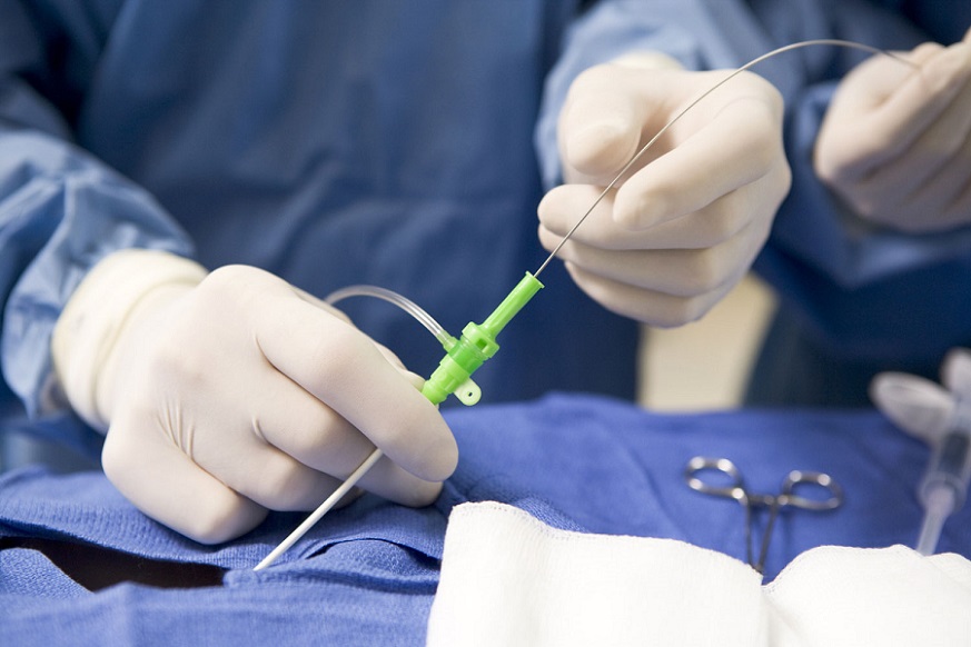 Хирурги института Склифосовского провели уникальную операцию на позвоночнике