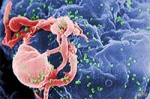 Генетики научились очищать геном человека от ВИЧ