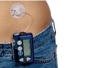 Более 200 детей больных сахарным диабетом получили устройства помповой инсулиновой терапии