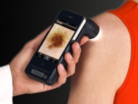 Новое мобильное приложение поможет диагностировать меланому