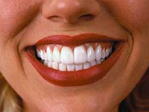 Ген FAM20A - новый ключ к здоровью зубов