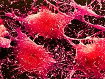 раковые клетки 2 .jpg